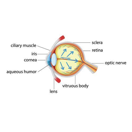 Graphic showing the anatomy of an eye with Glaucoma