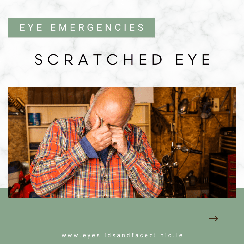 Scratched Eye Symptoms, Treatment and Prevention