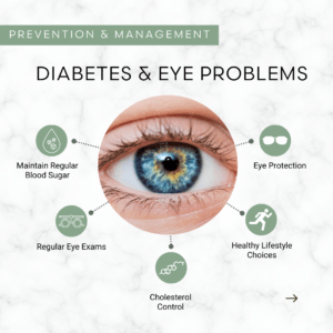 Graphic showing an eye and a list of eye problems associated with diabetes