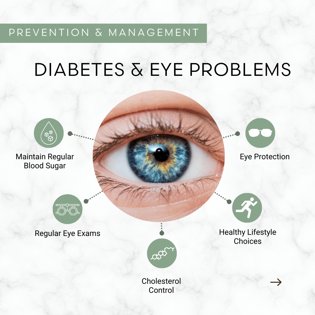Graphic showing an eye and a list of eye problems associated with diabetes