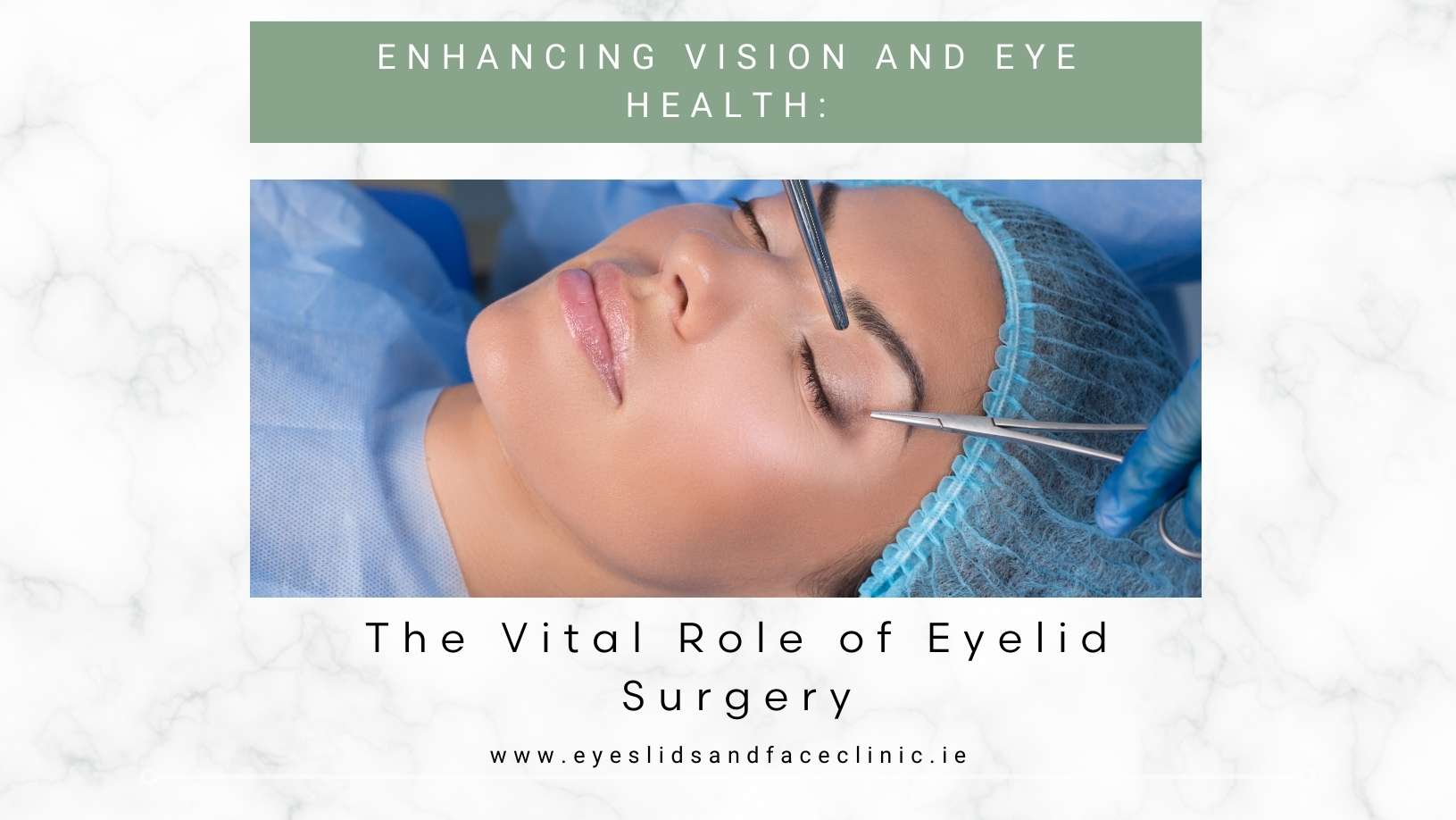 Eyelid Surgery Blog