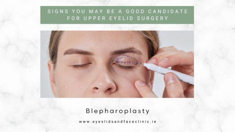 Upper Blepharoplasty blog image