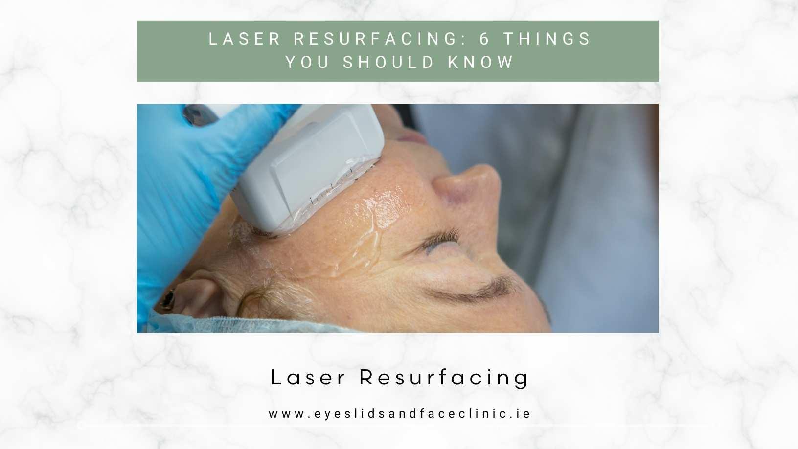 Laser Resurfacing