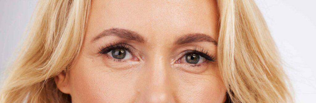 Blepharoplasty – Older Eye surgery - dr Maeve O'Doherty