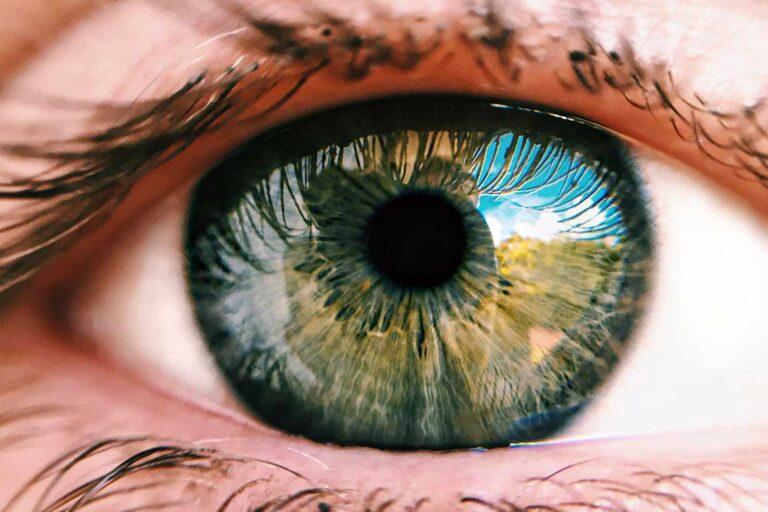 Dr-Maeve-o-doherty-eye-image3