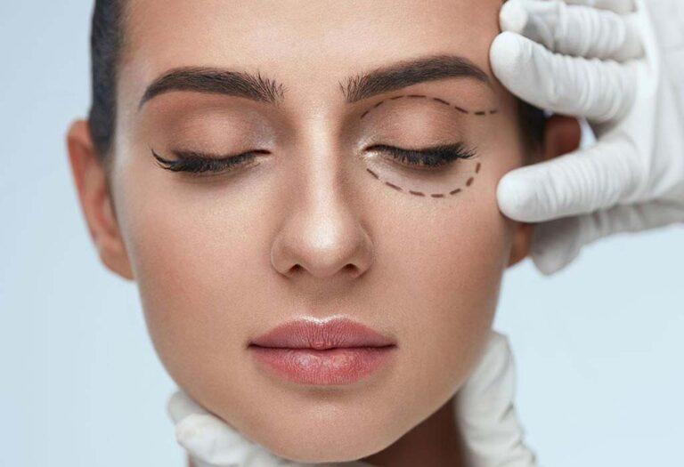 brow-lift-Blepharoplasty-Eyelid-Surgery-Galway-Dr-Maeve-ODoherty