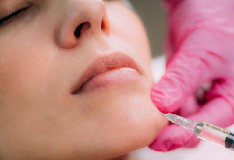 dermal-filler-Blepharoplasty-Eyelid-Surgery-Galway-Dr-Maeve-ODoherty