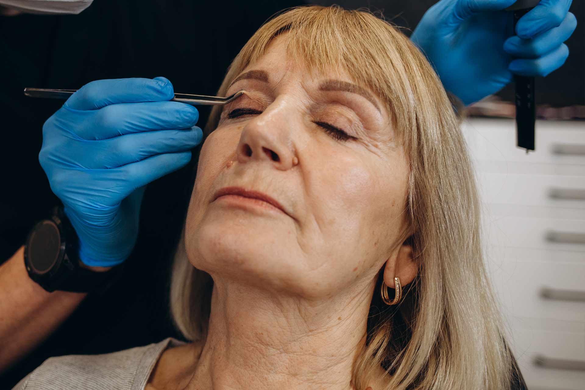 drmaeve-eyelid-surgery-blepharoplasty-skinlaser-ennis-ireland