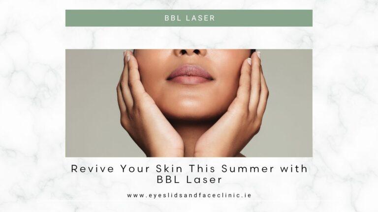bbl laser summer