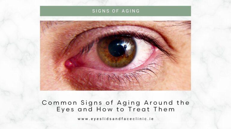 aging eye treatments