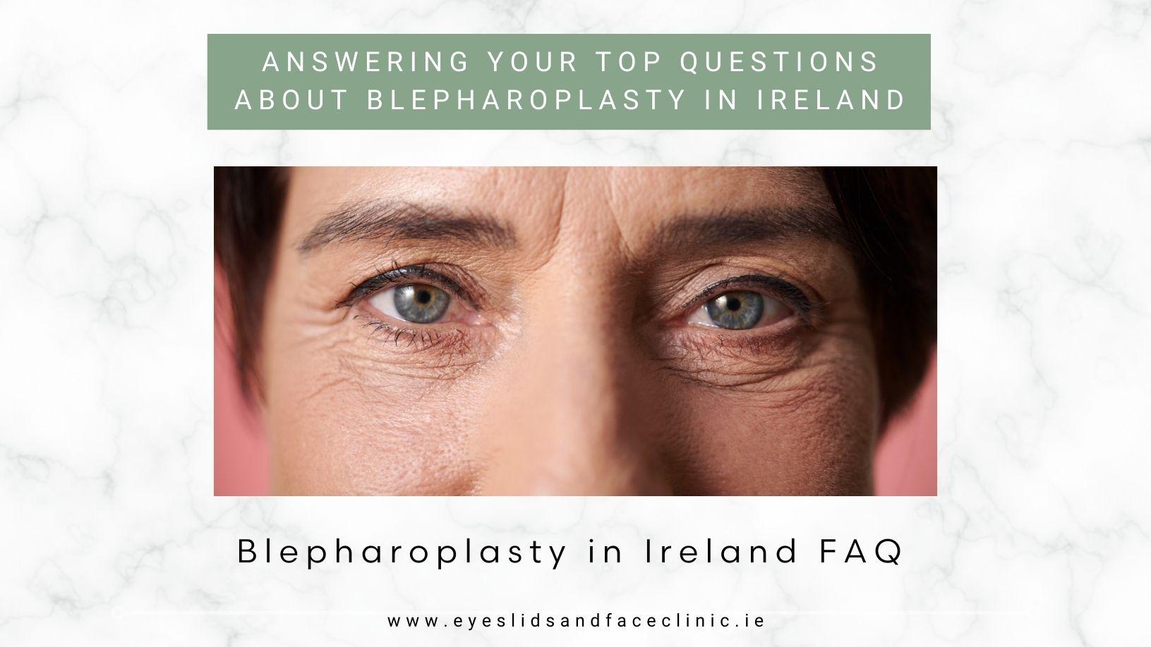 Bleph FAQ Ireland